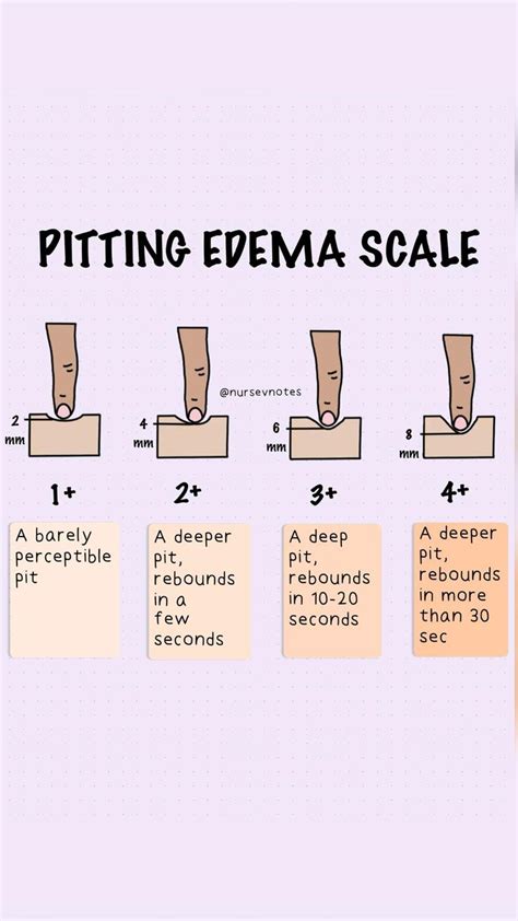 Pitting edema scale for nursing students and nurses | Medical school ...