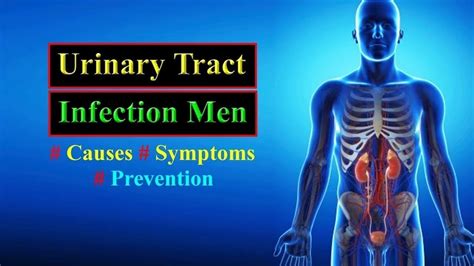 Urinary tract infection in men: causes, symptoms and treatment - YEN.COM.GH