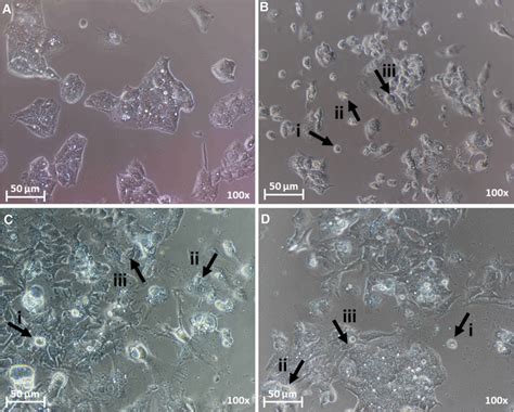 Morphological changes of HepG2 cells following treatment at 24 h. A ...