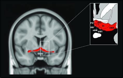 Representative figure of the basal forebrain and its anatomy, based on... | Download Scientific ...