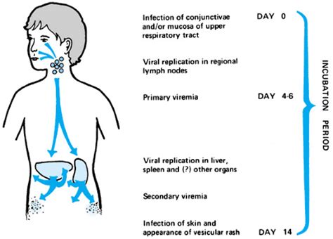 Varicella-Zoster Virus Infections | Musculoskeletal Key