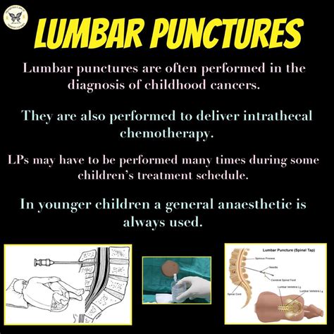 Lumbar Puncture (procedure) Day – The Amazing Noah