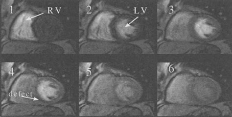 Perfusion MR images: (a) a perfusion image series showing the arrival ...