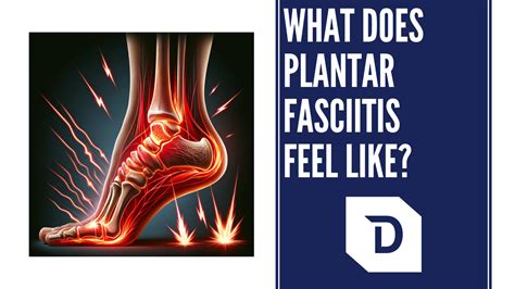 What Does Plantar Fasciitis Feel Like? Signs, and Symptoms