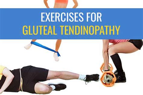 Exercises for gluteal tendinopathy