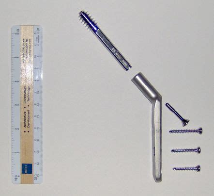 Dynamic hip screw | Radiology Reference Article | Radiopaedia.org