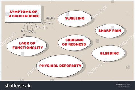 Symptoms Broken Bone Vector Illustration Medical Stock Vector (Royalty ...