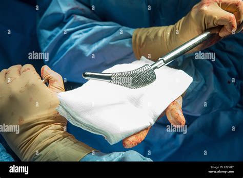 Hip prosthesis, surgery Stock Photo - Alamy