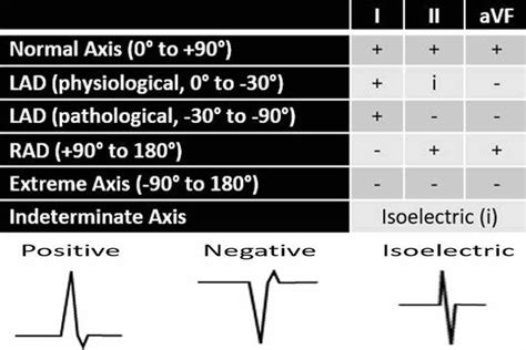 Heart left axis deviation causes, symptoms & treatment