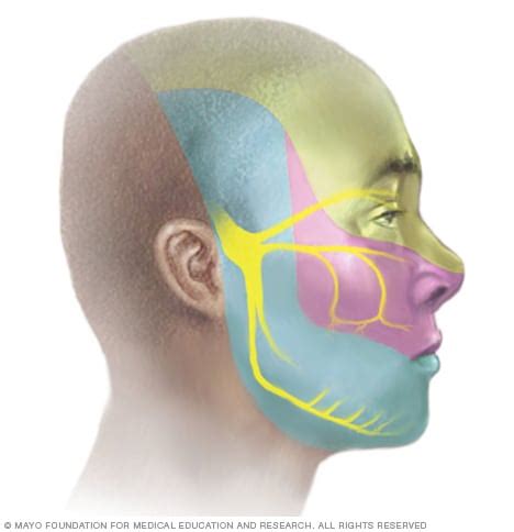 Trigeminal neuralgia - Symptoms and causes - Mayo Clinic