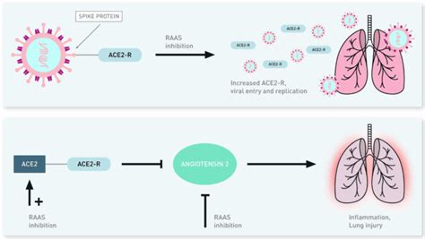 COVID-19: Clinical/Therapeutic Staging Proposal and Treatment - REBEL EM - Emergency Medicine Blog