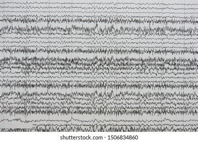 Background Brain Waves Electroencephalogram Monitoring Unit Stock ...