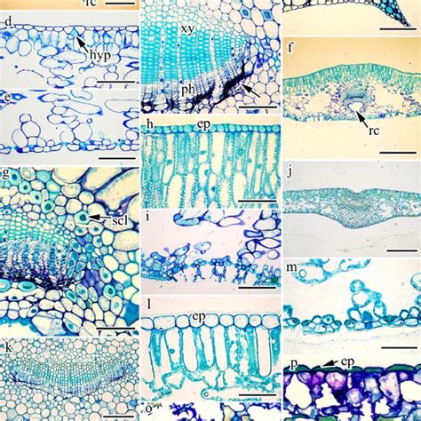 of leaf anatomical features of Taxaceae s. l. (number of samples ...