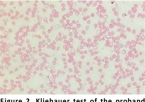 Figure 2 from Diagnosing delta-beta thalassaemia in a resource poor ...