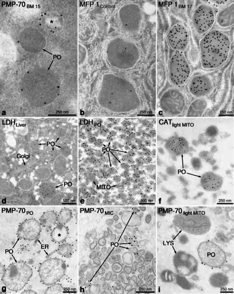 Peroxisome Electron Micrograph