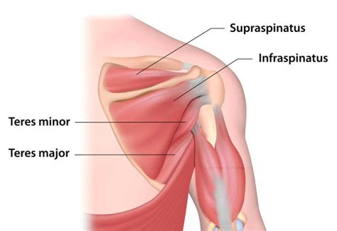 Supraspinatus Tear - Signs, Symptoms and Diagnosis