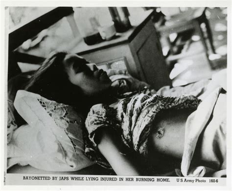 Filipina woman recovering from a bayonet wound, Philippines | The ...