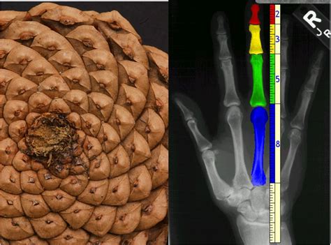 and 12. A pinecone with Fibonacci spiral and Fibonacci numbers on human ...