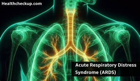 Slipping Rib Syndrome: Causes, Symptoms, Tests & Treatment