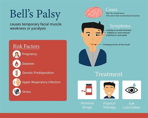 Bell's Palsy, Symptoms, Causes & Treatment | Birla Fertility & IVF