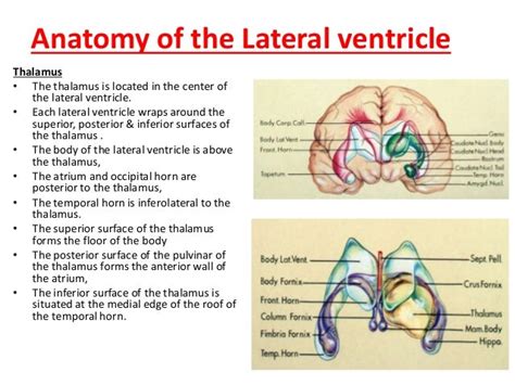 Surgical approach for tumors in the lateral and third ventricle