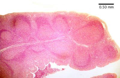 Lingual Tonsil Histology