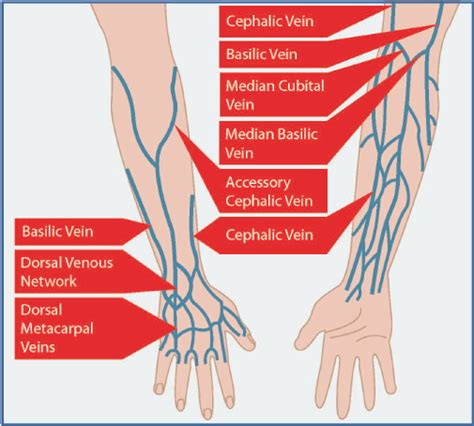 Intravenous access and care of the site | Nurse Key