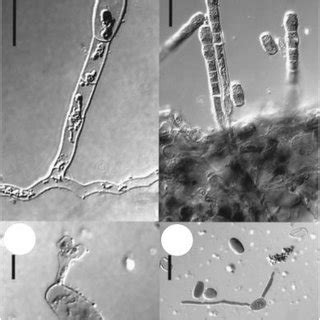 (PDF) Identification of two powdery mildew fungi, Oidium neolycopersici sp. nov. and O ...