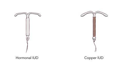 IUD Birth Control | Info About Mirena & Paragard IUDs