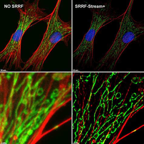 SRRF-Stream+ Super-Resolution Microscopy Accessible to All - FocalPlane