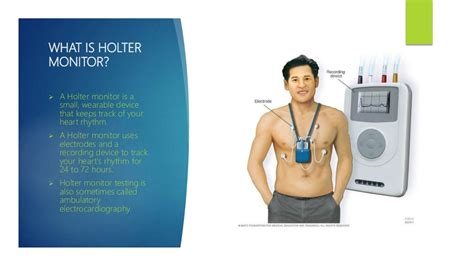 Holter monitoring