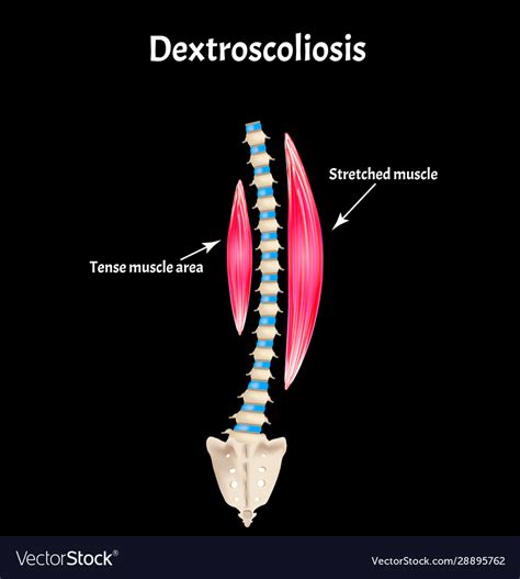 How painful is bulging disc surgery? - Health Blog