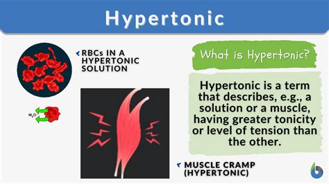 Hypertonic - Definition and Examples - Biology Online Dictionary