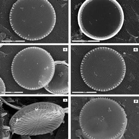 SEM micrographs of Cyclotella and Discostella. a-b-Cyclotella meduanae... | Download Scientific ...