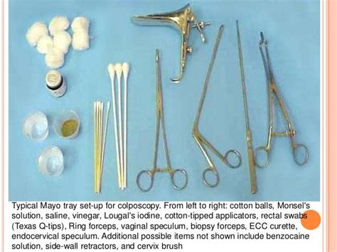 Colposcopy examination