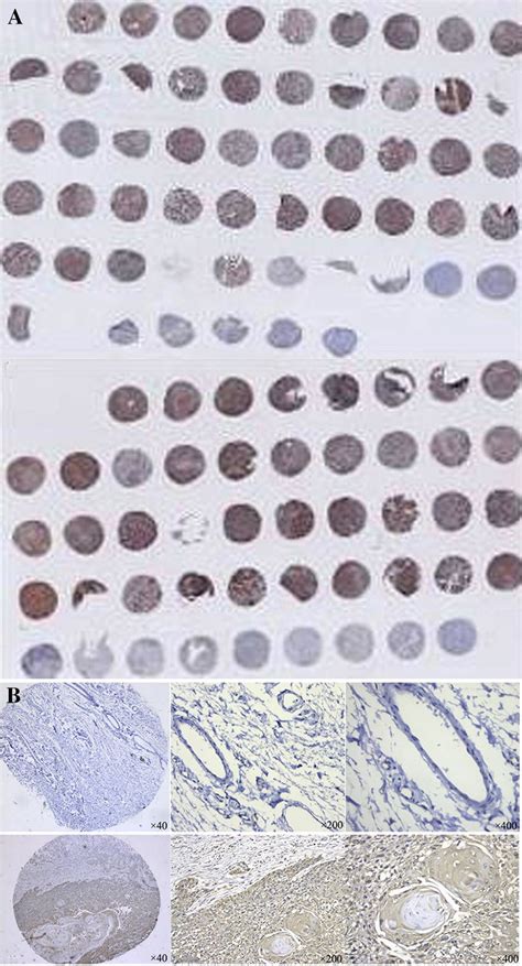 Tissue microarray. a One hundred and three specimens were detected... | Download Scientific Diagram