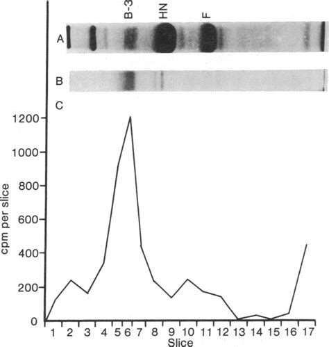 Sodium dodecyl sulfate/polyacrylamide gel electrophoresis. (A and B ...