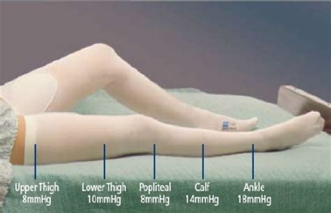 TED Compression Stockings - Complete Guide (with Pictures!)