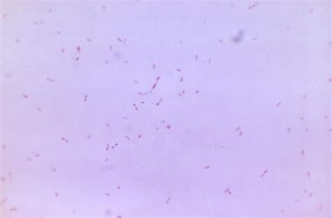 Fusobacterium - wikidoc