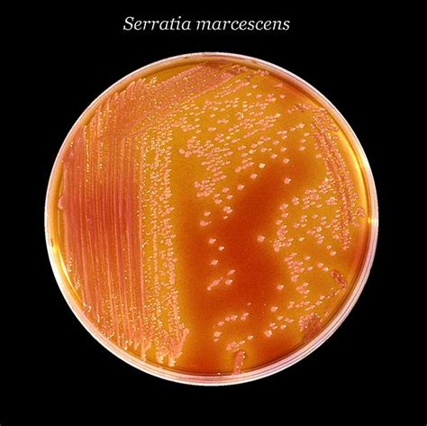 Klebsiella-Entrobacter-Serratia Group – howMed