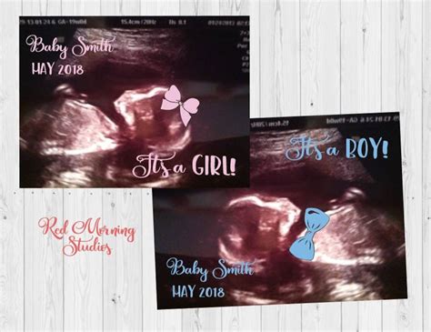 Ultrasound Gender Reveal. DIGITAL FILE. Sonogram Gender Announcement With Your Photo. Pregnancy ...