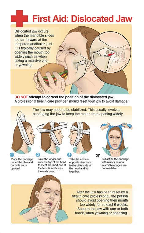 First Aid: Dislocated Jaw – I-Hsun Wu Biomedical Visualization