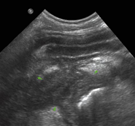 How Much Is A Dog Abdominal Ultrasound