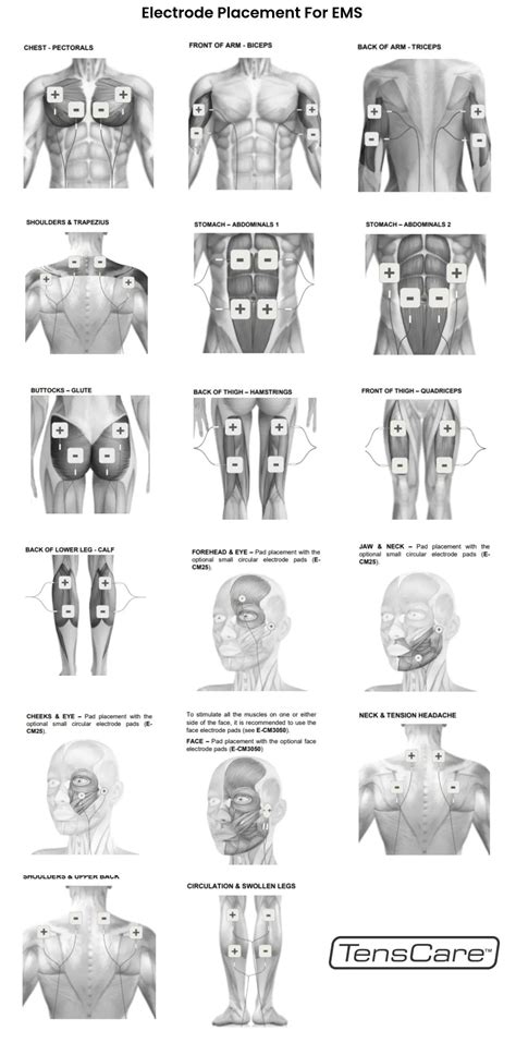 Female Ems Electrode Placement Chart - Draw Stunning Portraits