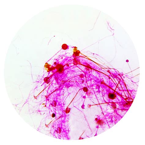 Rhizopus Stolonifer Under Microscope