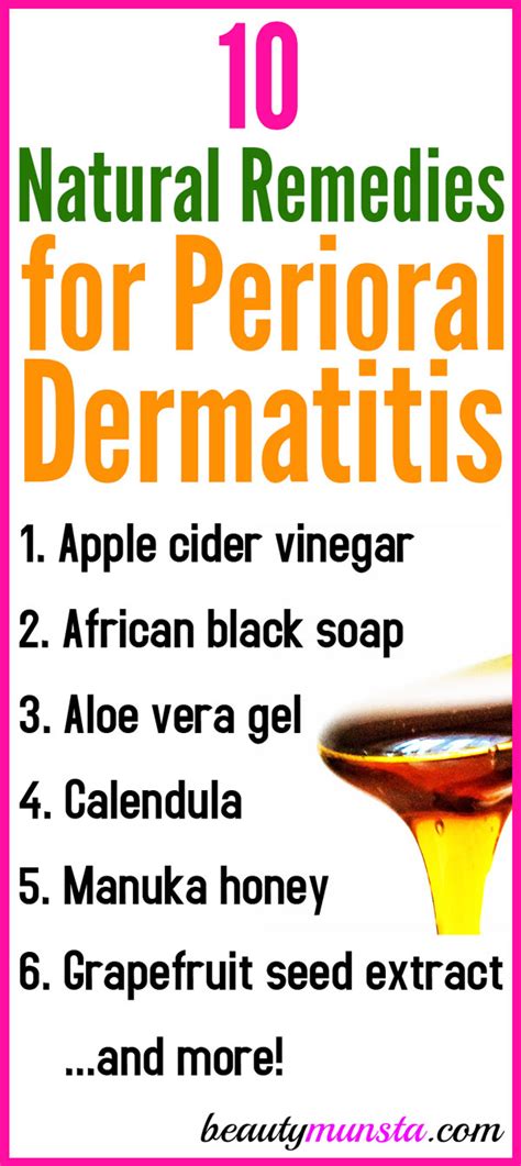 Top 10 Natural Remedies for Perioral Dermatitis (Including Recipes!) - beautymunsta - free ...