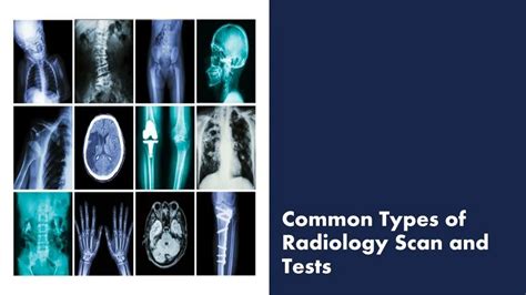 PPT - Common Types of Radiology Scan and Tests PowerPoint Presentation ...