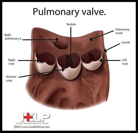 Pulmonary Valve