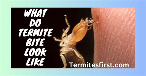 What Do Termite Bites Look Like? Symptoms and Misconceptions ...