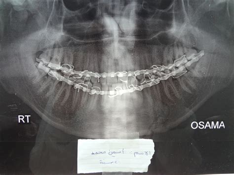 radiology ENT, Maxillofacial, Head and neck, neurosurgery, Dentology ...